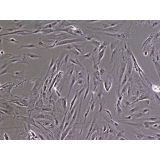 Human Hepatic Stellate Cells- Adult (HHSC)
